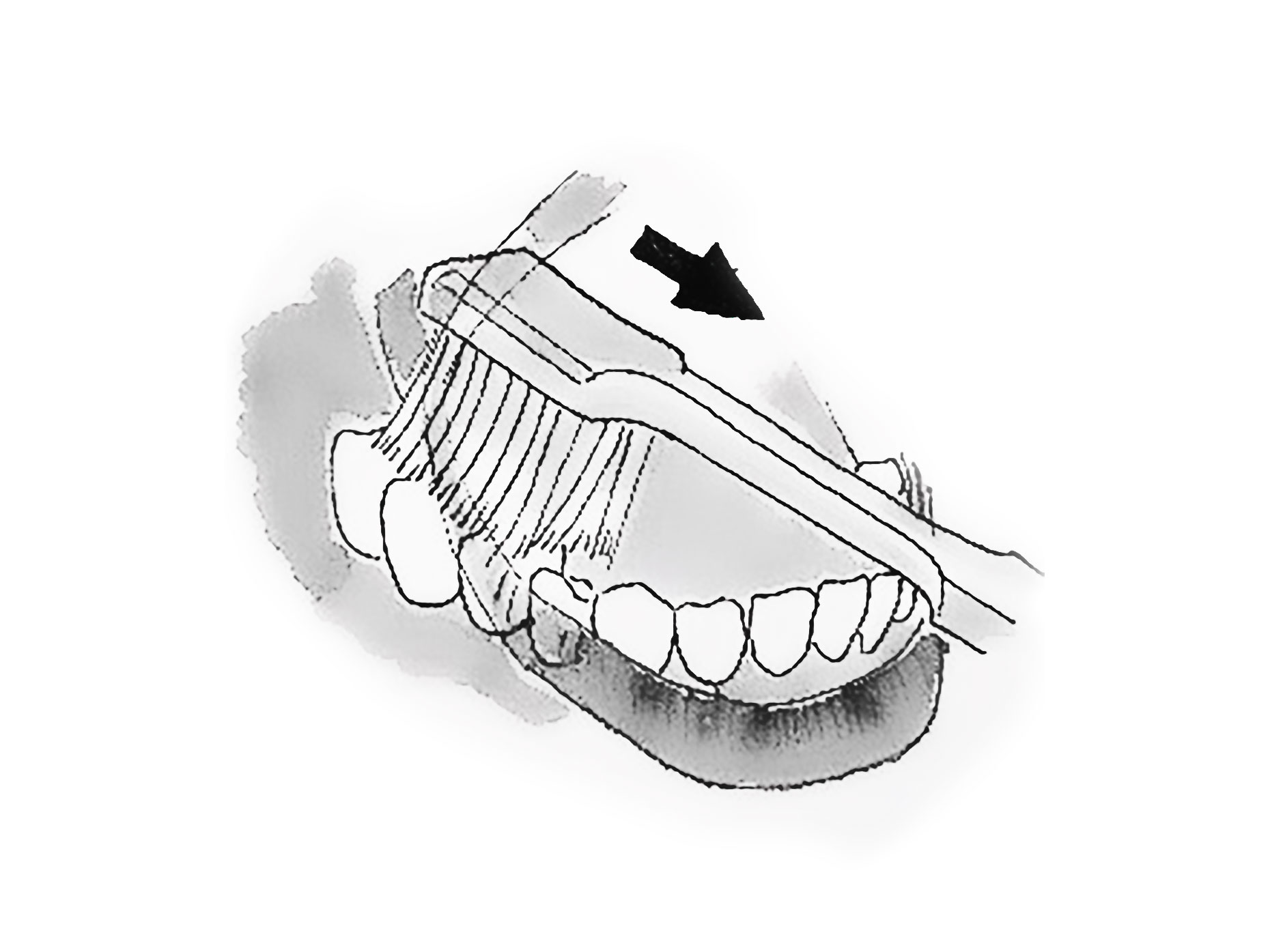 figura mostra la corretta pulizia dei denti posteriori