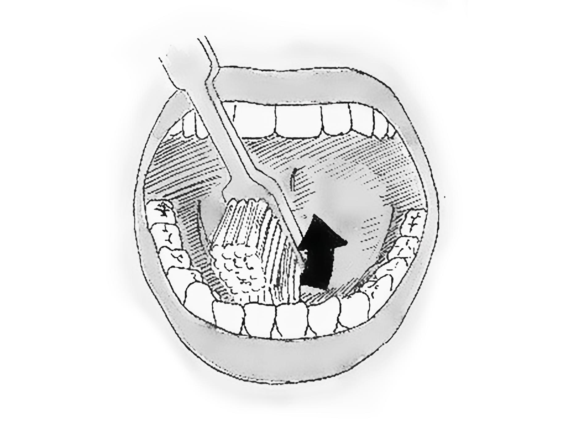 figura mostra il corretto movimento dello spazzolino per pulire i denti anteriori