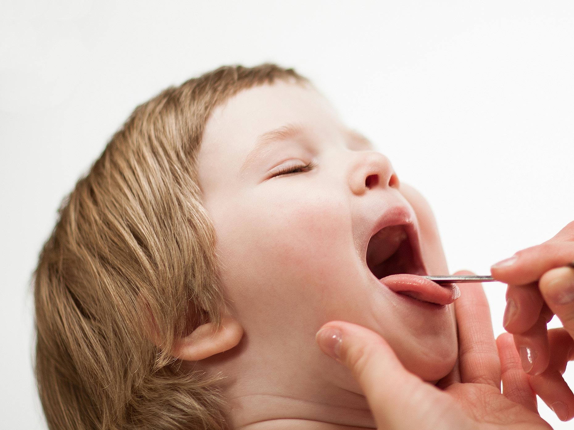 Слюнотечение у ребенка. Раздражительность рта у детей.
