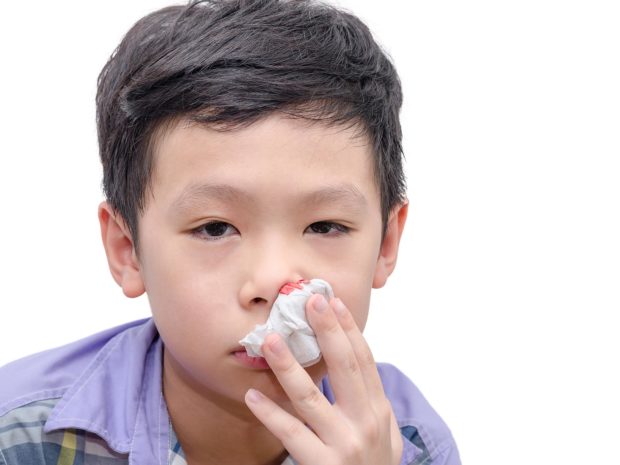 bambino asiatico copre naso insanguinato con un fazzoletto