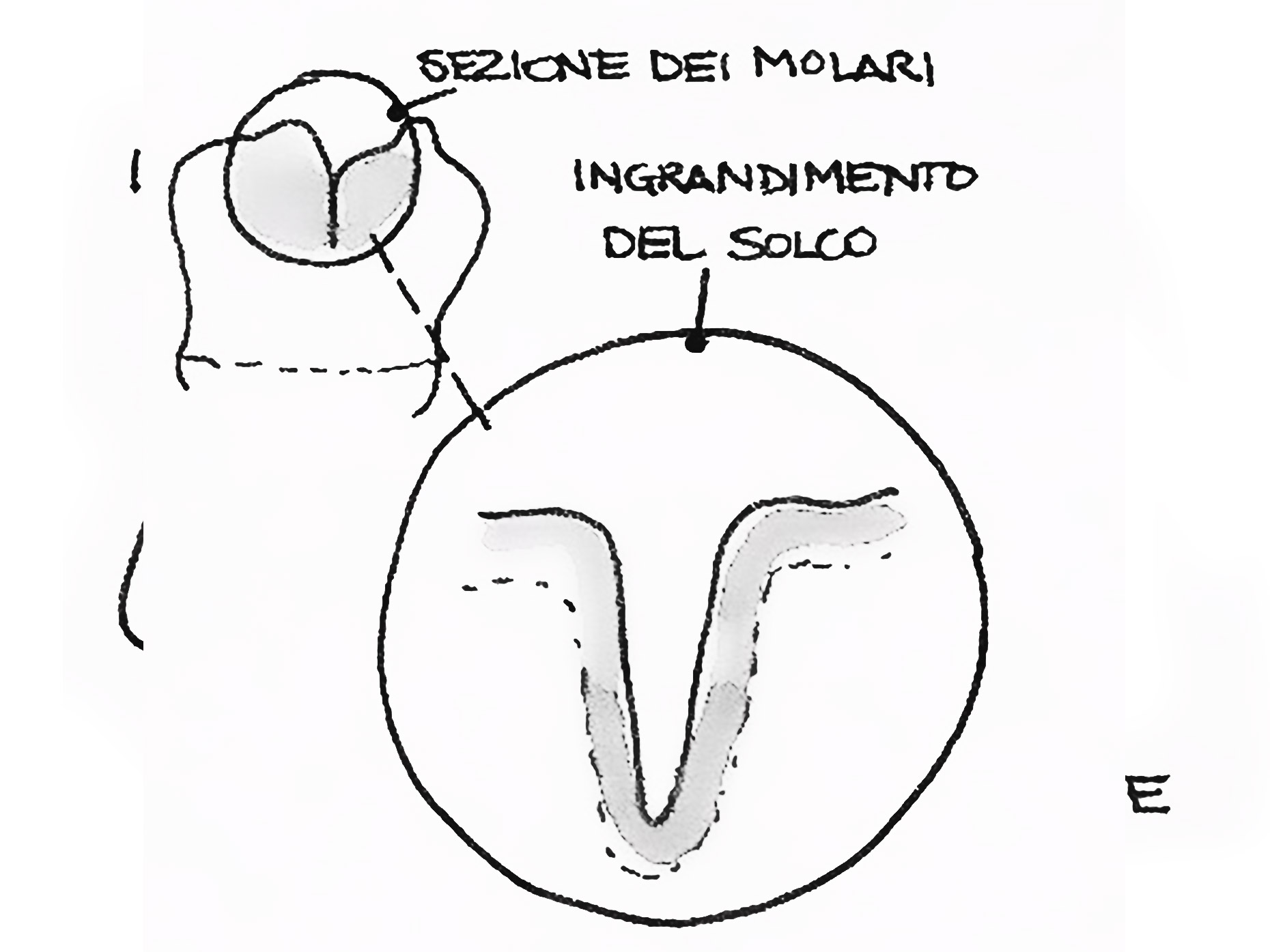 disegno che mostra il solco tra i molari