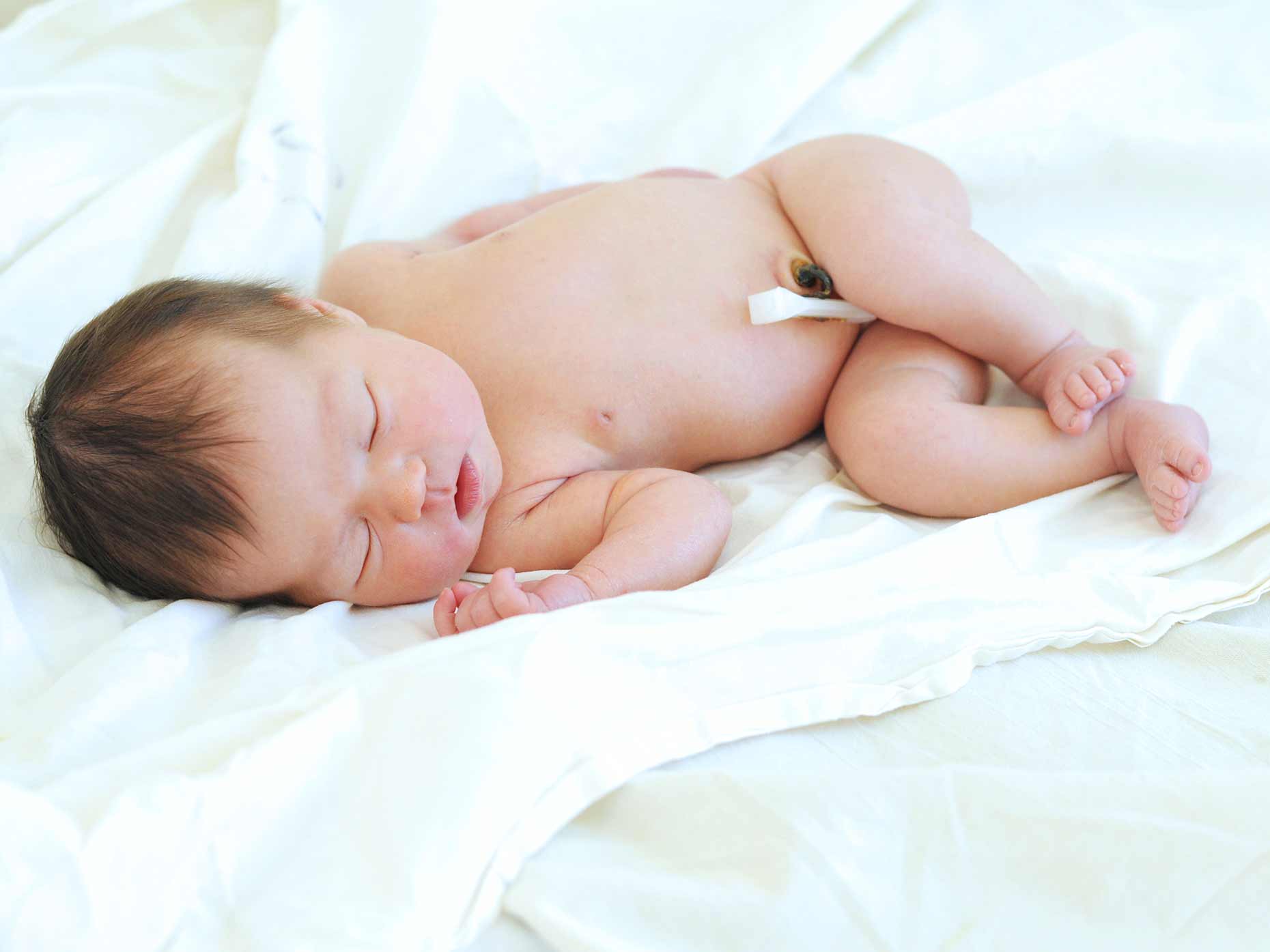 Come medicare il moncone ombelicale del neonato - Amico Pediatra